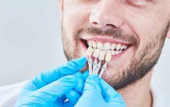 All You Need To Know Before Getting Dental Veneers